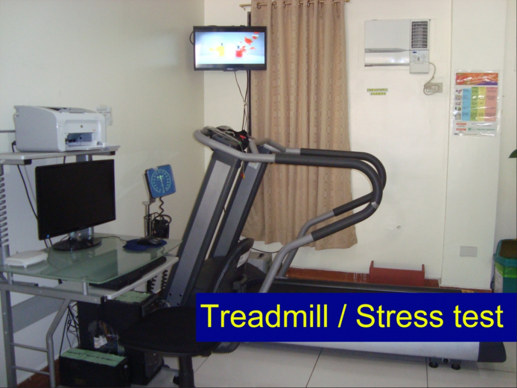 treadmill stress test